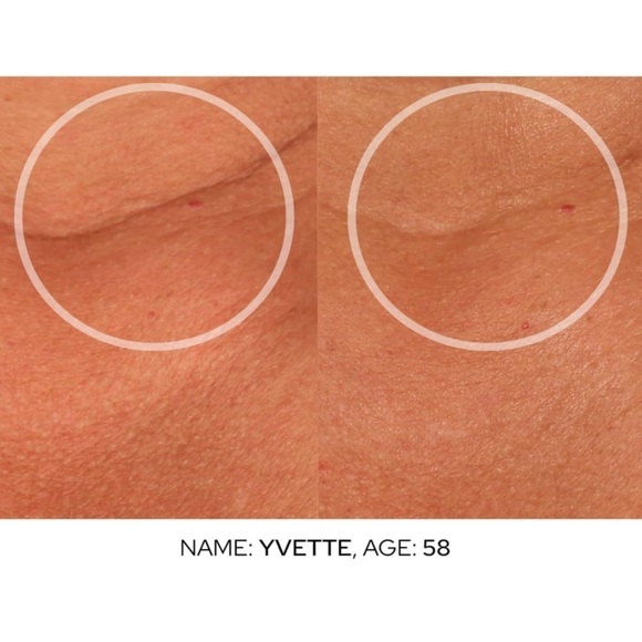 SiO Cryo Neck & Décolleté Cream Firm & Smoothing Neck & Décolleté Treatment #G35 - Picture 4 of 14